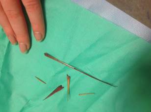 Splinters